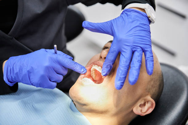 Best Emergency Denture Repair in St Clairsville, OH